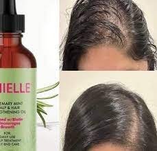 زيت إكليل الجبل والنعناع - الصورة 5